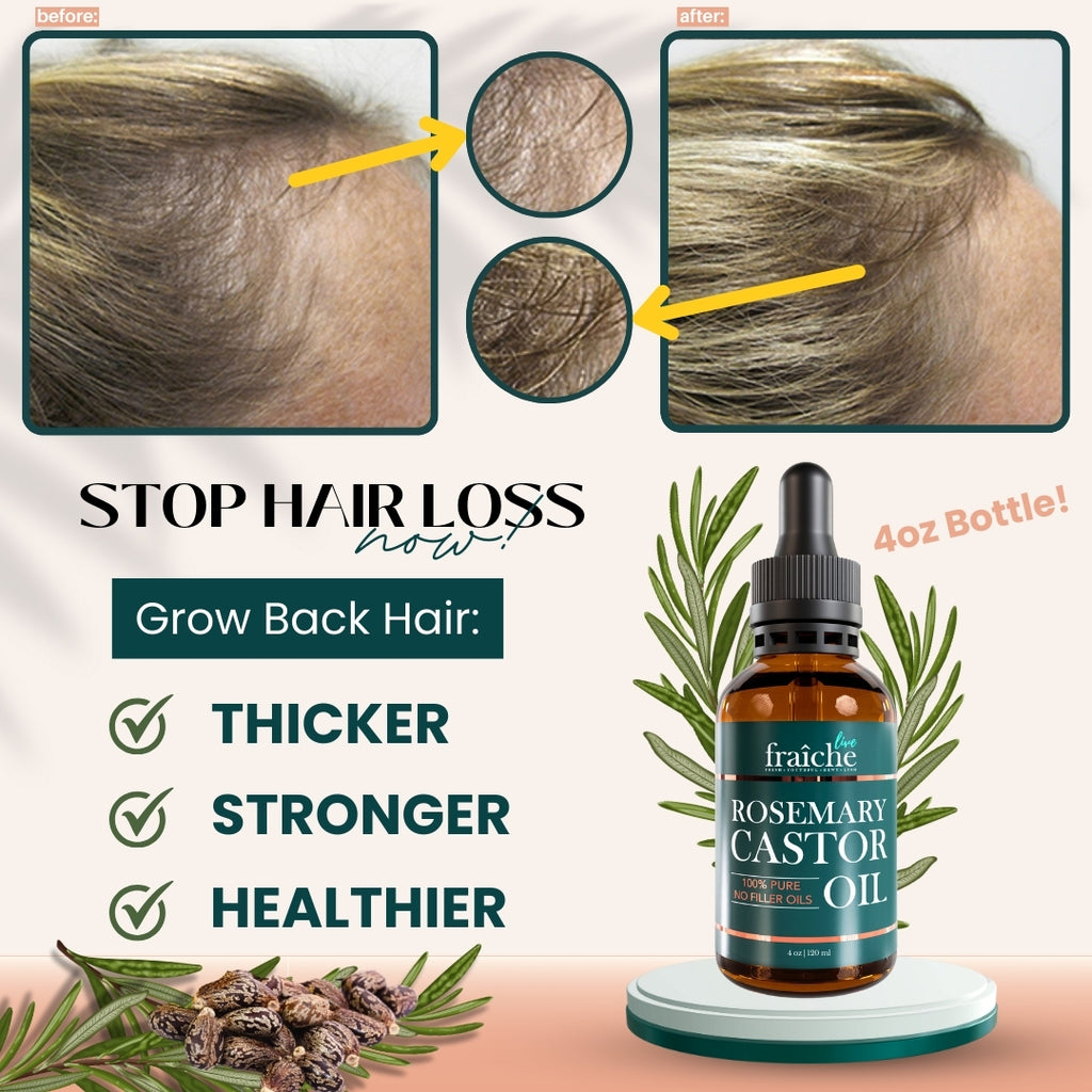 Live Fraiche Rosemary Castor Oil Hair Serum