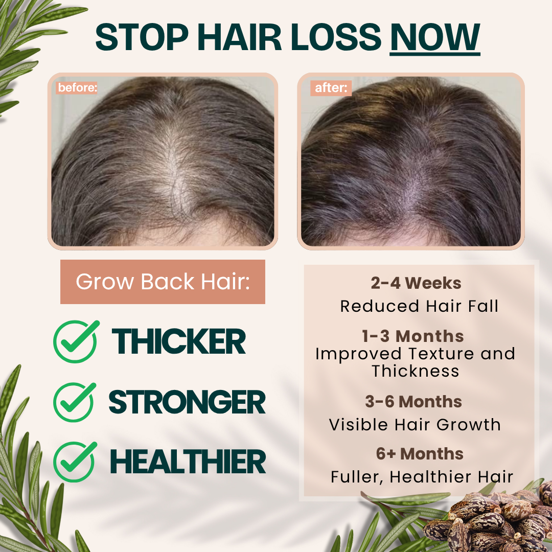 Rosemary Castor Scalp Detox & Growth Oil